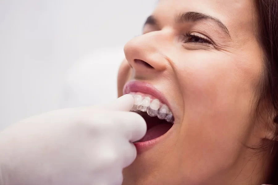 Clareamento Dental em Brasília